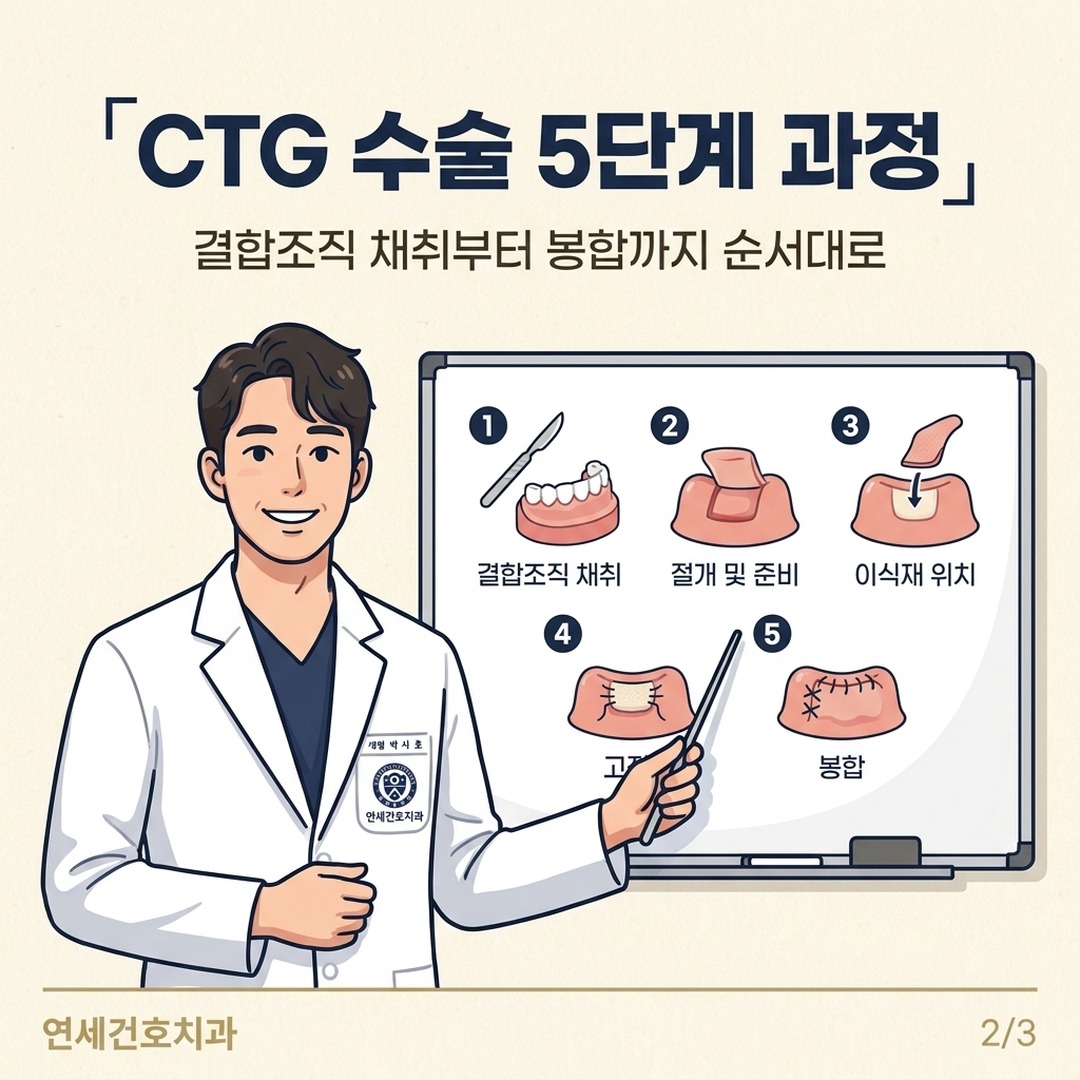 결합조직이식술 CTG 수술 과정 단계별 설명 잠실치과