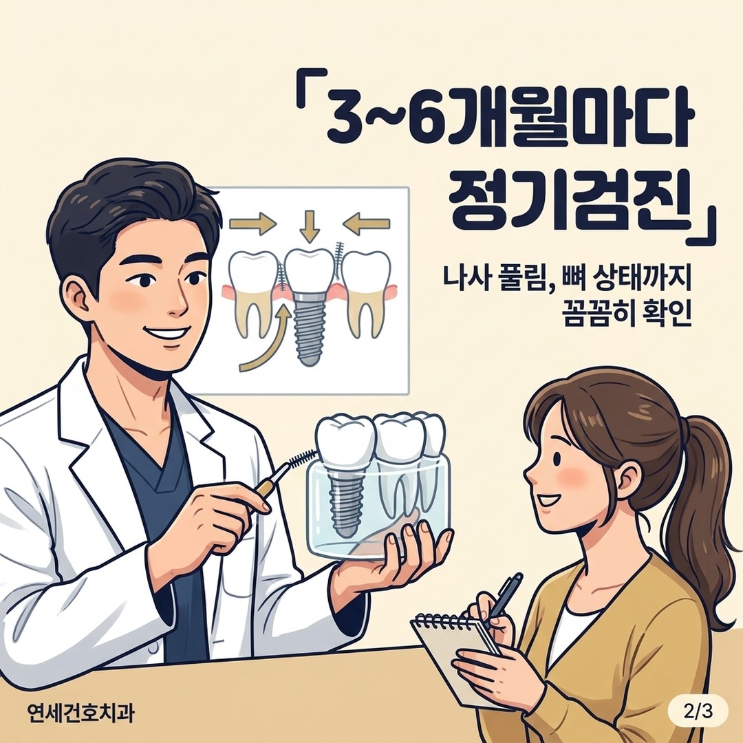 임플란트 정기검진 주기와 점검 항목 안내 이미지