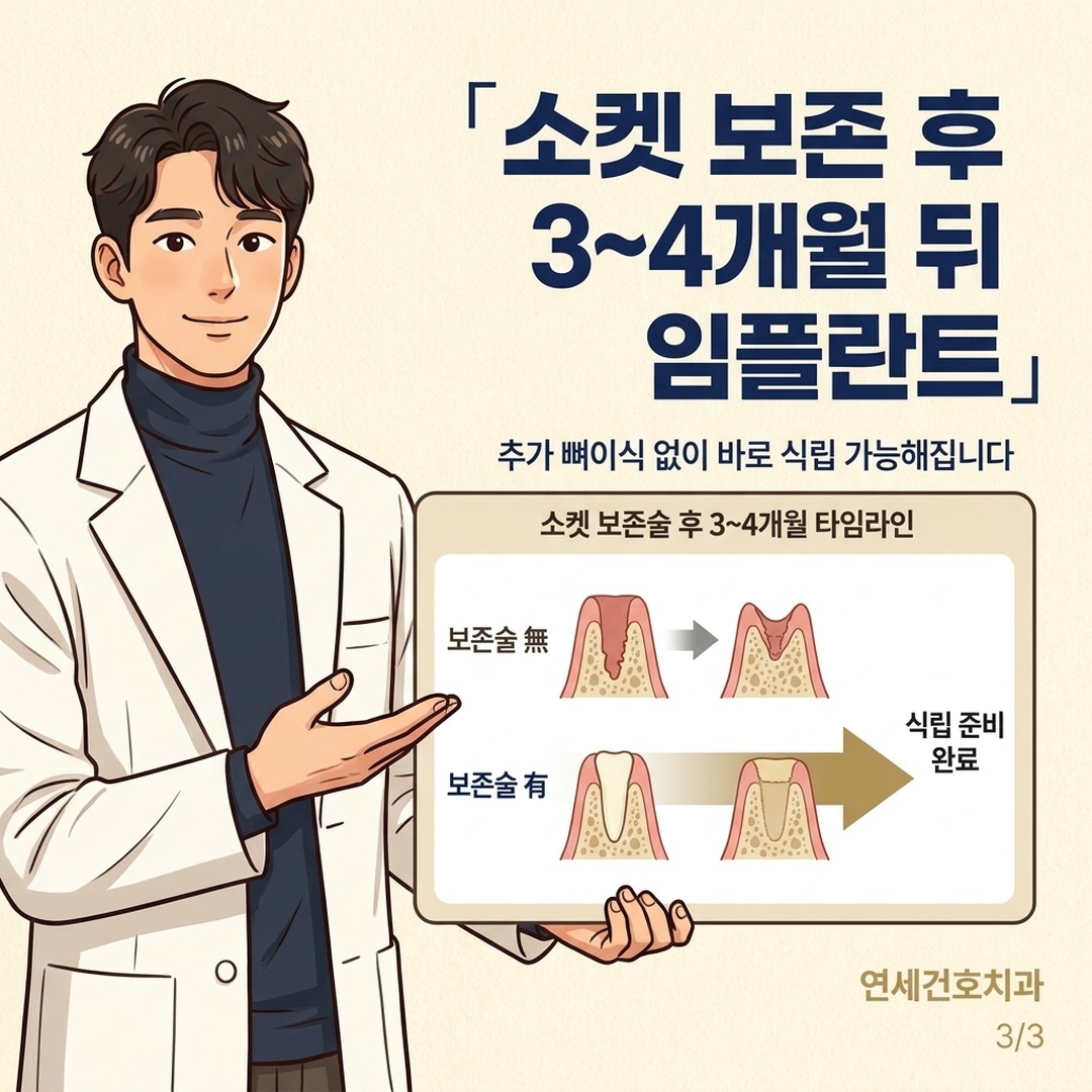 발치와 보존술 후 임플란트 식립 시기 안내 일러스트