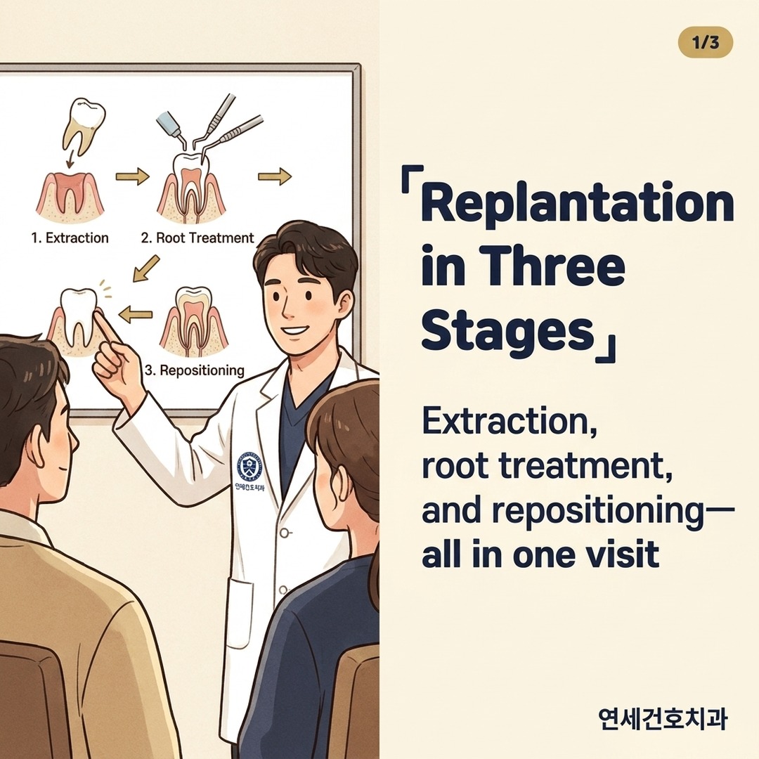 Dentist explaining intentional tooth replantation procedure with three-stage diagram showing extraction and reimplantation steps
