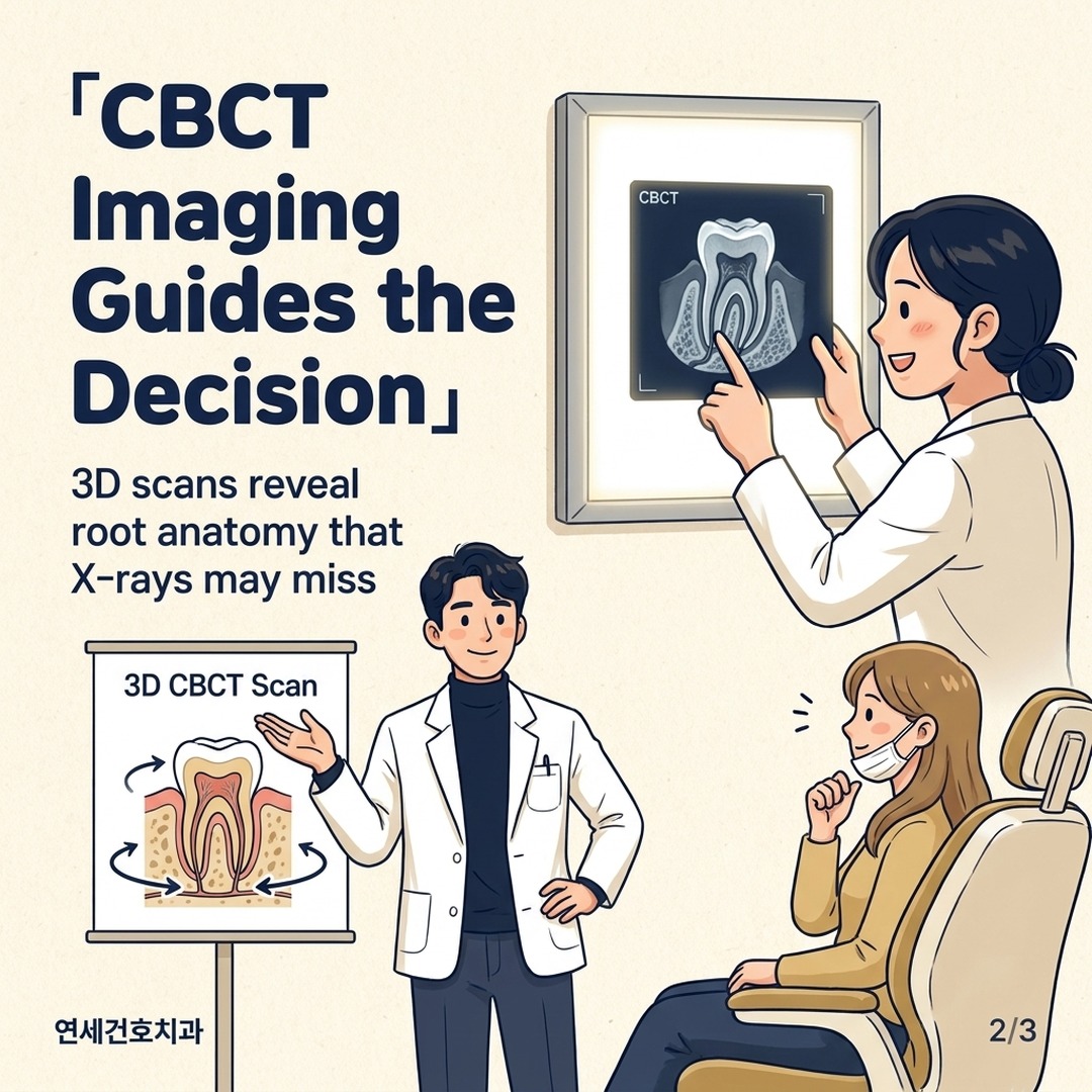 Oral surgeon reviewing CBCT scan of molar roots before intentional replantation to assess candidacy
