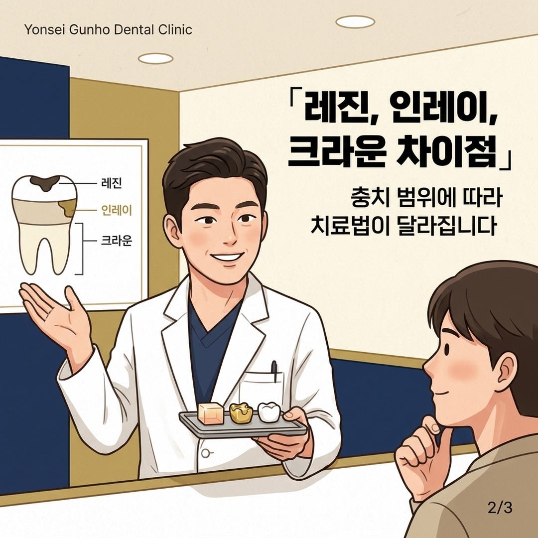 잠실 레진 인레이 크라운 치료 비교 설명