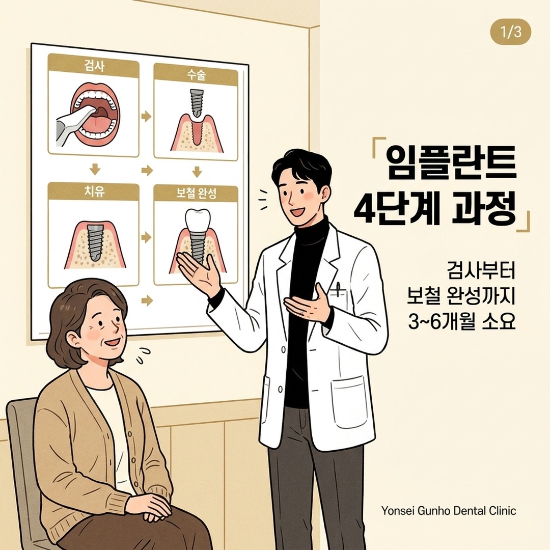 잠실 임플란트 치료 4단계 과정 설명하는 치과 전문의 일러스트