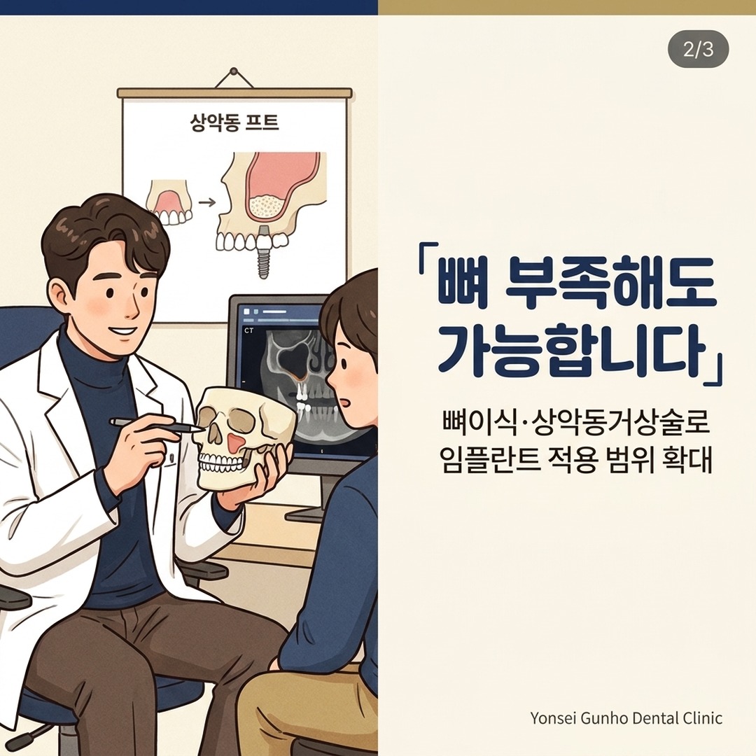 잠실 상악동거상술 뼈이식 설명하는 구강악안면외과 전문의 만화
