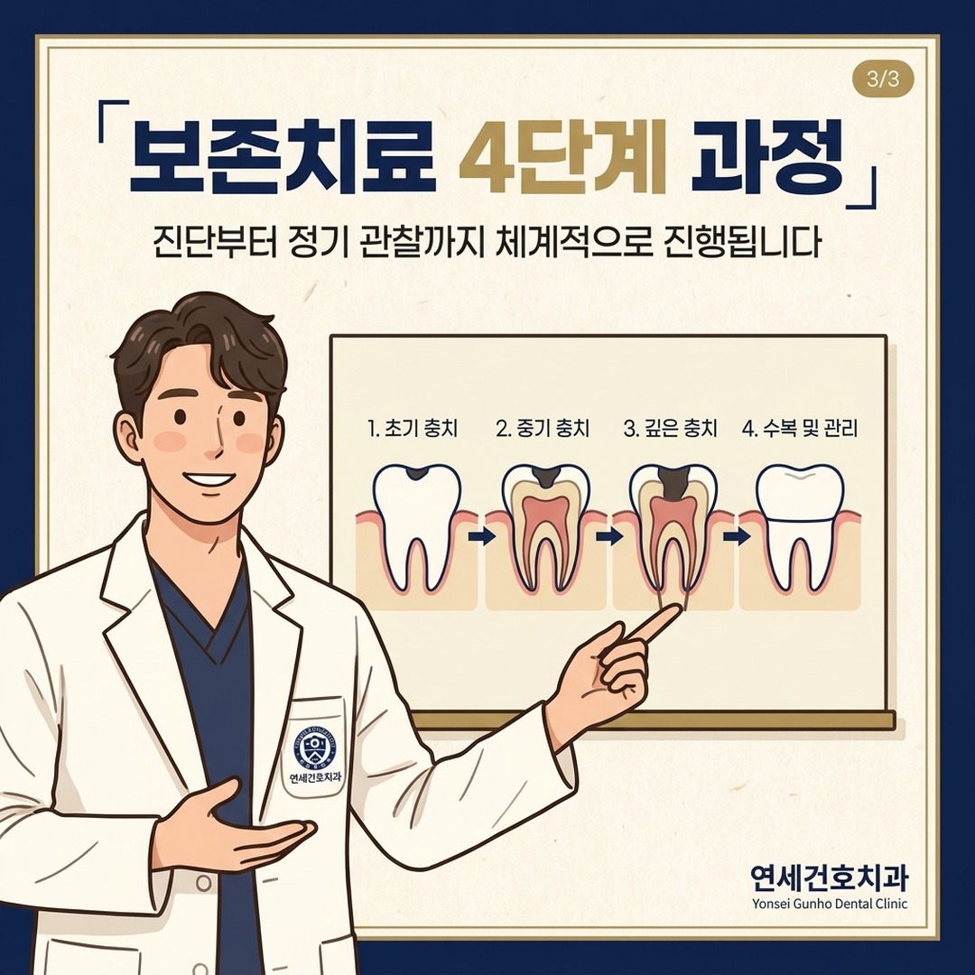 잠실치과 자연치아 보존치료 단계별 설명 일러스트