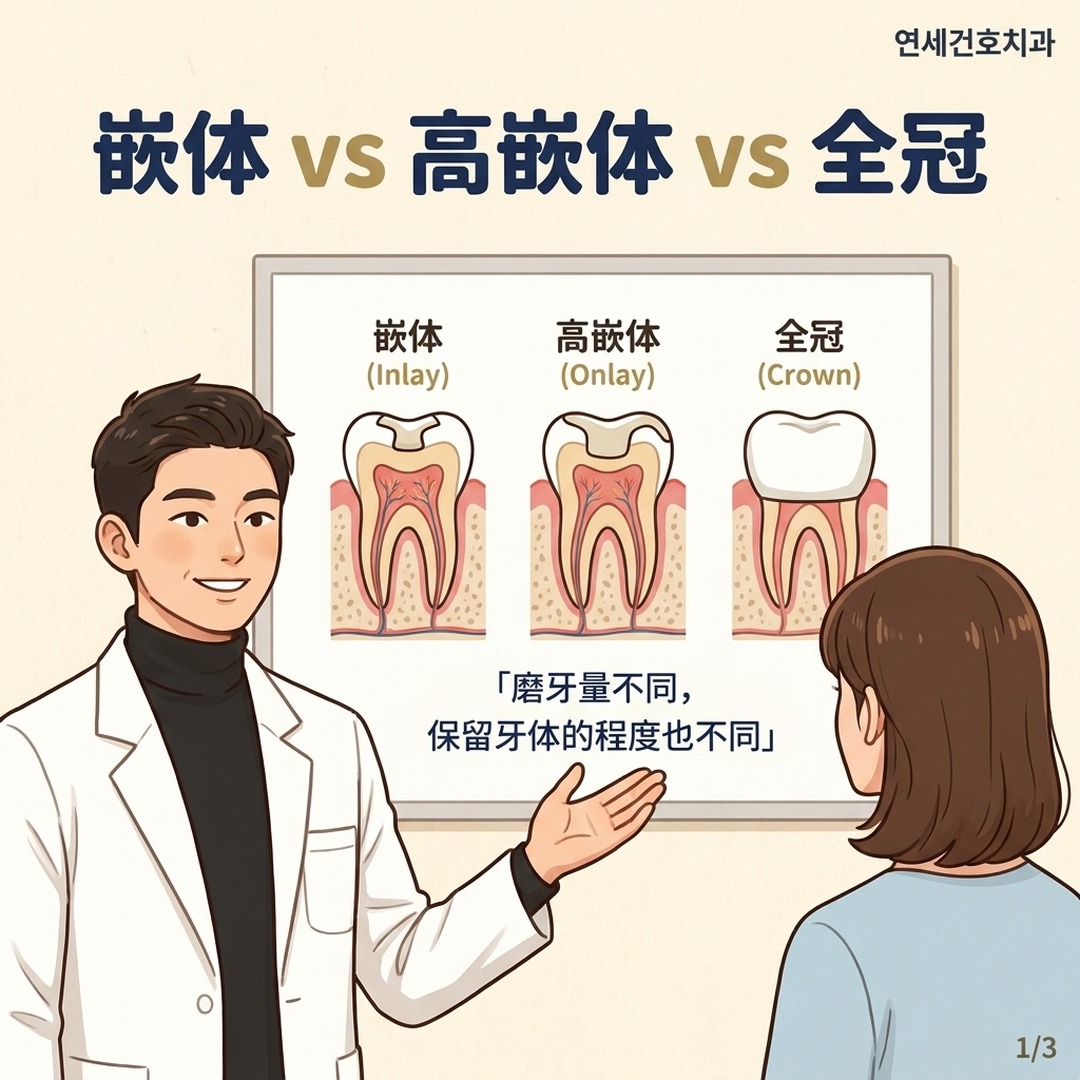 牙科医生讲解后牙嵌体与高嵌体区别示意图